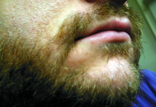 2008_02_my_beard_2.jpg