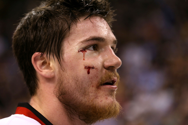2013_8_26_shaw_stitches.jpg